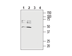Anti-MCT4 (SLC16A3) Antibody