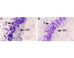 Anti-NGF Antibody