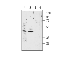 Anti-Nicotinic Acetylcholine Receptor α1 (CHRNA1) (extracellular) Antibody