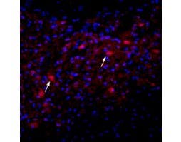 Anti-Nicotinic Acetylcholine Receptor α2 (CHRNA2) (extracellular) Antibody