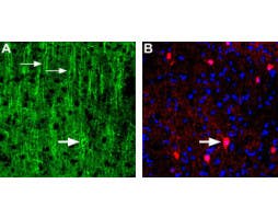 Anti-Nicotinic Acetylcholine Receptor α3 (CHRNA3) (extracellular) Antibody