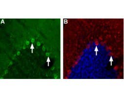 Anti-Nicotinic Acetylcholine Receptor α4 (CHRNA4) (extracellular) Antibody