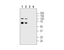 Anti-Nicotinic Acetylcholine Receptor α5 (CHRNA5) (extracellular) Antibody