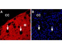 Anti-Nicotinic Acetylcholine Receptor α6 (CHRNA6) (extracellular) Antibody
