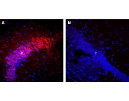 Guinea Pig Anti-Nicotinic Acetylcholine Receptor α7 (CHRNA7) (extracellular) Antibody