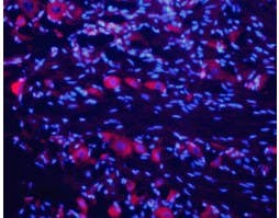 Anti-Nicotinic Acetylcholine Receptor α7 (CHRNA7) (extracellular) Antibody