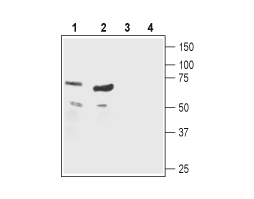 Anti-Nicotinic Acetylcholine Receptor β1 (CHRNB1) (extracellular) Antibody