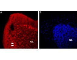 Anti-Nicotinic Acetylcholine Receptor β2 (CHRNB2) (extracellular)-ATTO Fluor-594 Antibody