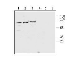 Anti-Nicotinic Acetylcholine Receptor β2 (CHRNB2) (extracellular) Antibody