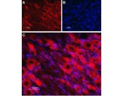 Anti-Nicotinic Acetylcholine Receptor β4 (CHRNB4) (extracellular)-ATTO Fluor-594 Antibody