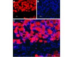 Anti-Nicotinic Acetylcholine Receptor β4 (CHRNB4) (extracellular) Antibody