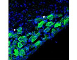 Anti-Nicotinic Acetylcholine Receptor α9 (CHRNA9) Antibody