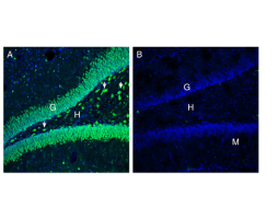 Anti-ATP1B3 (extracellular) Antibody