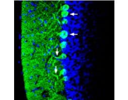 Anti-Synapsin I (SYN1) Antibody