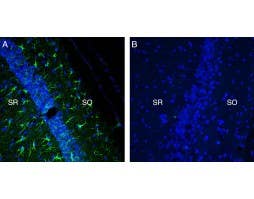 Anti-TREM2 (extracellular) Antibody