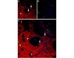 Anti-NPY1R Antibody