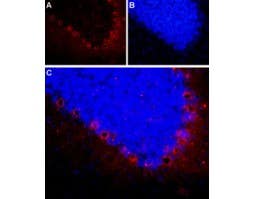 Anti-NPY2R Antibody