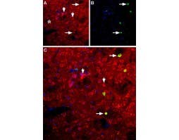 Anti-NPY5R Antibody