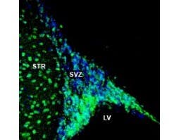 Anti-NPY1R (extracellular) Antibody
