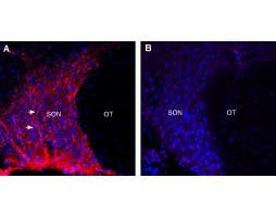 Anti-Neuropeptide S Receptor (extracellular) Antibody