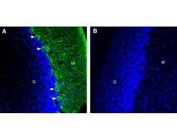Anti-DSCAM (extracellular) Antibody