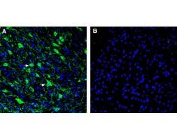 Anti-L1CAM (extracellular) Antibody