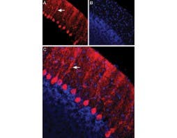 Anti-Nectin-1/PVRL1 (extracellular) Antibody