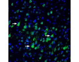 Anti-Nectin-3/PVRL3 (extracellular) Antibody