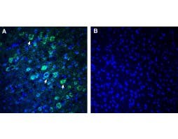 Anti-NEGR1 (extracellular) Antibody