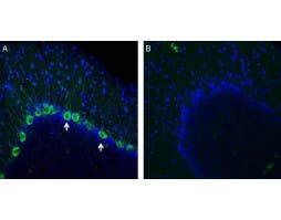 Anti-NMUR1 (extracellular) Antibody