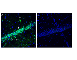 Anti-NMUR2 (extracellular) Antibody