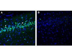 Anti-Neuropeptide FF Receptor 1 (extracellular) Antibody