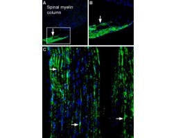 Anti-Periaxin Antibody