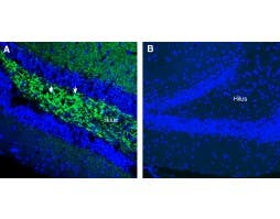 Anti-SV2A Antibody