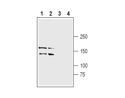 Anti-LRRK1 Antibody