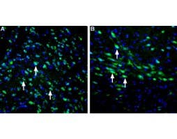 Anti-LRRK2 Antibody