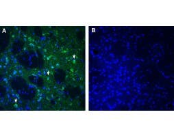 Anti-SLC25A18 (GC2) Antibody