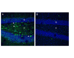 Anti-Netrin-1 Antibody