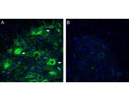 Anti-Netrin-3 Antibody