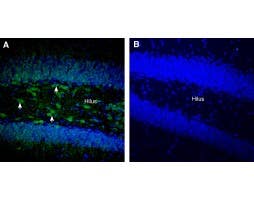 Anti-RGMA (extracellular) Antibody