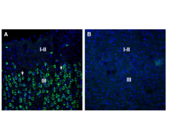 Anti-SORL1 (extracellular) Antibody