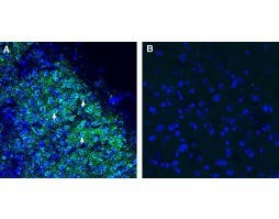 Anti-SORCS1 (extracellular) Antibody