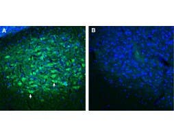 Anti-SORCS2 (extracellular) Antibody