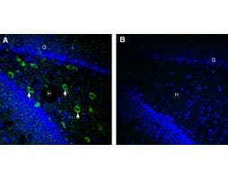 Anti-SARM1 Antibody