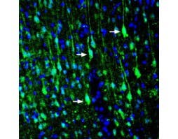 Anti-LRRTM1 (extracellular) Antibody
