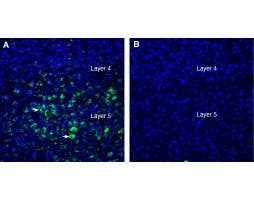 Anti-LRRTM2 (extracellular) Antibody