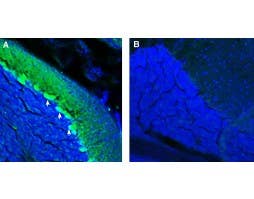 Anti-ADAM23 (extracellular) Antibody