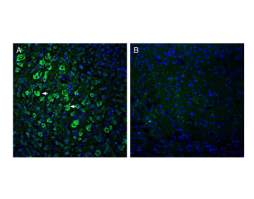 Anti-ADAM10 (extracellular) Antibody