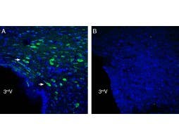 Anti-NGL-2/LRRC4 (extracellular) Antibody