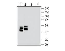 Anti-RAGE (extracellular) Antibody